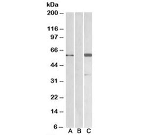Western blot testing of HEK293 lysate over expressing human BAIAP2-FLAG probed with BAIAP2 antibody