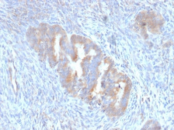 IHC staining of FFPE human endometrium with ATG5 antibody (clone ATG5/2101). Required HIER: boil tis