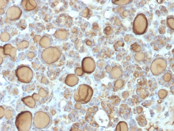 IHC testing of FFPE human thyroid gland with recombinant TG antibody (clone TGB/1970R). Required HIE