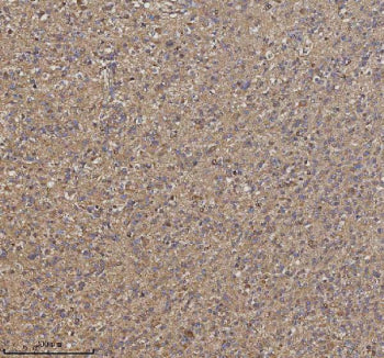 Immunohistochemical staining of TRIM2 using anti-TRIM2 antibody. TRIM2 was detected in a paraffin-em