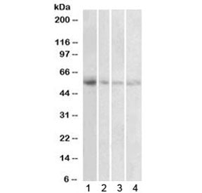 Western blot testing of human 1) placenta, 2) uterus, 3) adrenal gland and 4) pancreas lysate with V