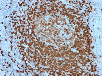 IHC testing of FFPE human lymph node with TCL1 antibody. HIER: boil tissue sections in pH 9 10mM Tri
