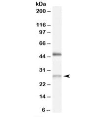 Western blot testing of human kidney lysate with BNIP1 antibody at 0.5ug/ml. Predicted molecular wei