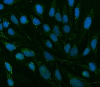 TMEM88 Antibody / Transmembrane protein 88