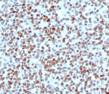 IHC testing of FFPE human tonsil with Nucleolin antibody (clone NPC23-2). FFPE testing requires sect