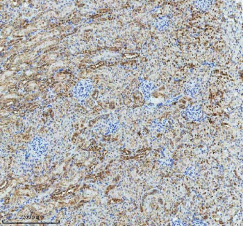 Immunohistochemical staining of GLG1 using anti-GLG1 antibody. GLG1 was detected in a paraffin-embed