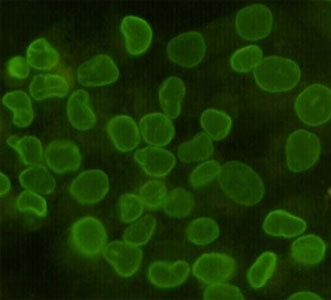 Lamin B1 Antibody