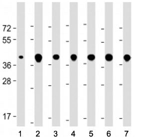 Western blot testing of TOMM40 antibody at 1:2000: Lane 1) human brain, 2) HEK293, 3) U-87 MG, 4) Hu