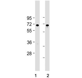 Western blot testing of human 1) A549 and 2) HeLa cell lysate with FOXN1 antibody. Predicted molecul