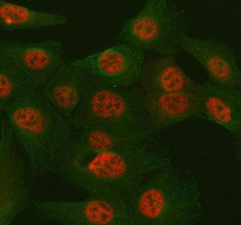 Immunofluorescent staining of FFPE human U-2 OS cells with TULP3 antibody (red) and Alpha Tubulin mA