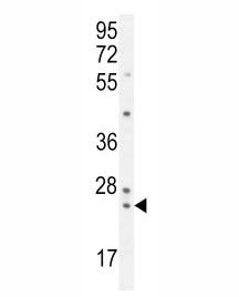 PAUF antibody western blot analysis in K562 lysate.
