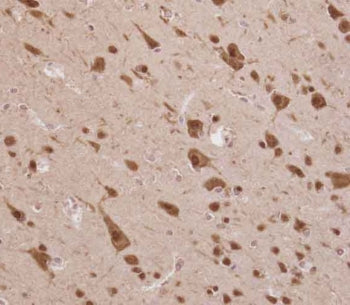 IHC testing of FFPE human brain tissue with ELAVL2 antibody. HIER: steam section in pH6 citrate buff