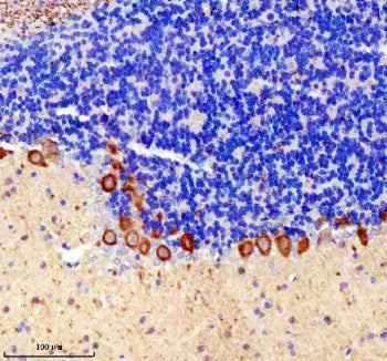 PRKCG Antibody / Protein kinase C gamma, 100ul