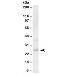 Western blot testing of human brain lysate with ERAB antibody at 0.3ug/ml. Predicted molecular weigh