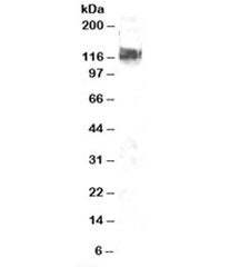 Western blot testing of NIH3T3 lysate with CBL antibody at 2ug/ml. Expected molecular weight: 100-12