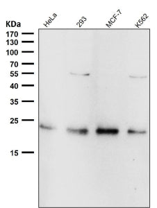 All lanes use the RAB22A antibody at 1:2000 dilution for 1 hour at room temperature. Predicted molec