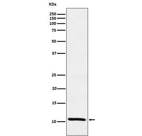 Estrogen Inducible Protein pS2 / TFF1 Antibody