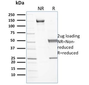 SPTB Antibody / Spectrin beta