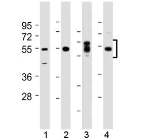 SGK1 Antibody (N-Terminal Region)