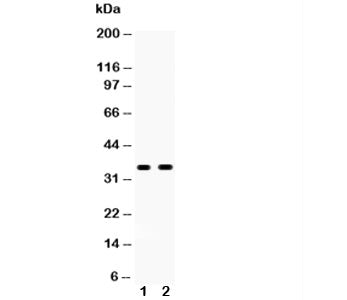 FRZB Antibody
