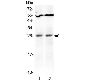 LIGHT Antibody / TNFSF14 / HVEML