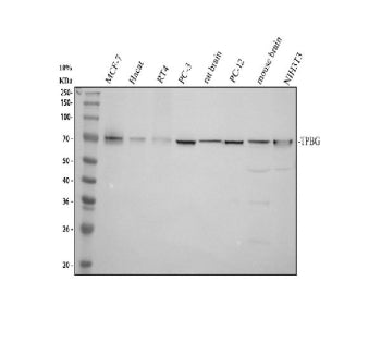 Western blot analysis of TPBG using anti-TPBG antibody. Electrophoresis was performed on a 10% SDS-P