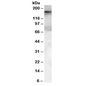 Western blot testing of HeLa lysate with GEF5 antibody at 0.1ug/ml. Predicted molecular weight: ~177