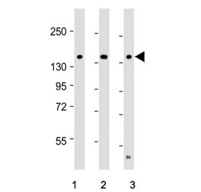 Western blot testing of human 1) Ramos, 2) HCT-116 and 3) RPM1 8226 cell lysate with TIAM1 antibody.