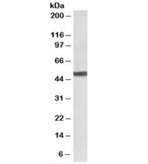 Western blot testing of human liver lysate with CYP24A1 antibody at 0.1ug/ml. Predicted molecular we