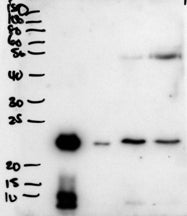 Western blot testing of secretions from human primary airway cells in culture (lanes 1 and 2), and i