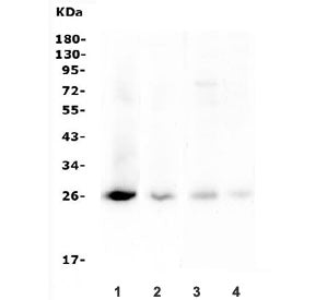 Western blot testing of 1) human SK-OV-3, 2) human 22RV1, 3) rat ovary and 4) mouse ovary lysate wit