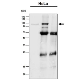 Immunoprecipitation analysis using the antibody at 1:50 dilution (Western blot at 1:1000 dilution).