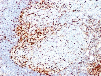 IHC analysis of formalin-fixed, paraffin-embedded human tonsil stained with ZAP-70 antibody (clone 2