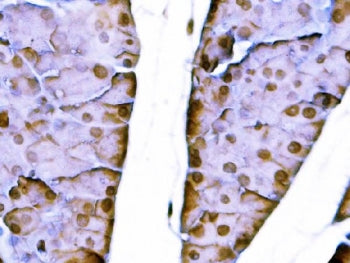 Sox11 Antibody
