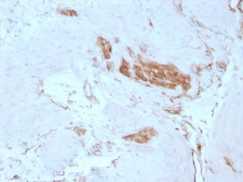 SPTAN1 Antibody / Alpha II Spectrin / Fodrin / NEAS