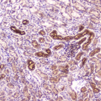IHC testing of FFPE mouse kidney tissue with IGFBP2 antibody at 2ug/ml. HIER: boil tissue sections i