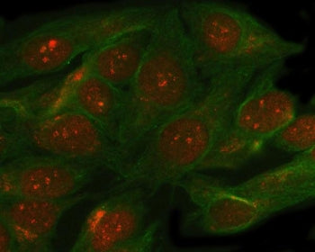 SMC5 Antibody / Structural maintenance of chromosomes protein 5