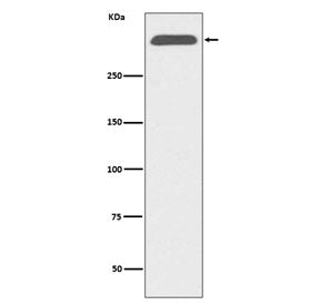 Western blot testing of human serum lysate with Apolipoprotein B antibody. Predicted molecular weigh