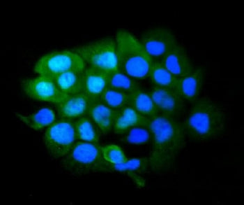 Immunofluorescent staining of FFPE human A431 cells with SLBP antibody (green) and DAPI nuclear stai