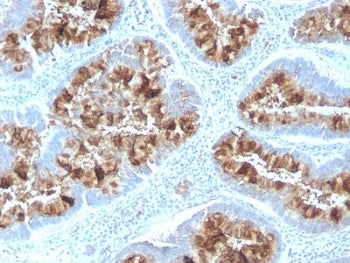 IHC testing of FFPE human colon with recombinant Mucin-1 antibody (clone MUC1/2818R). Required HIER: