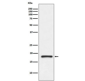 Western blot testing of human fetal kidney lysate with Prealbumin antibody. Predicted molecular weig