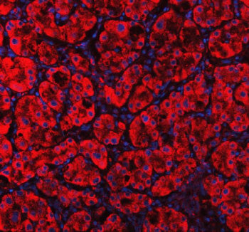 Immunofluorescent staining of MVK using anti-MVK antibody (red). MVK was detected in a paraffin-embe
