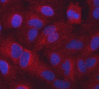 Immunofluorescent staining of FFPE human A549 cells with SARS1 antibody (red) and DAPI nuclear stain