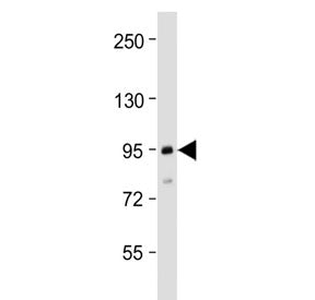 Western blot testing of human MCF7 cell lysate with TGFBR3 antibody at 1:2000. Predicted molecular w