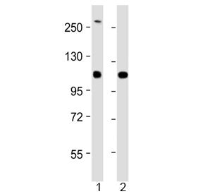 Western blot testing of 1) human SH-SY5Y and 2) mouse Neuro-2a cell lysate with NF-H antibody at 1:2