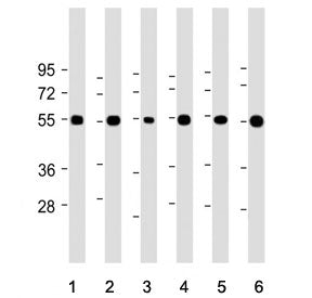Western blot testing of 1) human brain, 2) human cerebellum, 3) human U-87 MG, 4) mouse brain, 5) mo