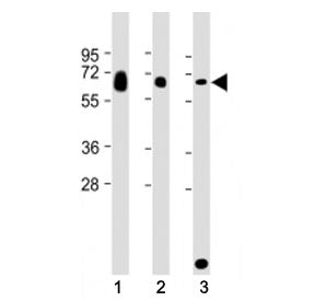 Western blot testing of GGT3P antibody at 1:2000: Lane 1) human ovary, 2) human testis and 3) rat ki