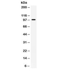 Western blot testing of Jurkat cell lysate with TLR5 antibody. Expected/observed molecular weight ~9