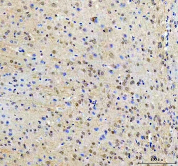 IHC staining of FFPE mouse brain tissue with RTF1 antibody. HIER: boil tissue sections in pH8 EDTA f