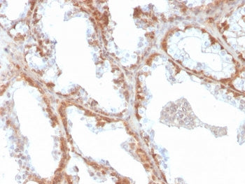 IHC staining of FFPE human prostate with SOD1 antibody. HIER: boil tissue sections in pH 9 10mM Tris